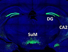 RIKEN Center for Brain Science (RIKEN CBS)